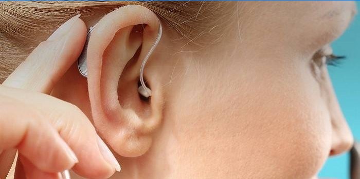 Tüdruku kõrvas kõrva taga olev kuuldeaparaat