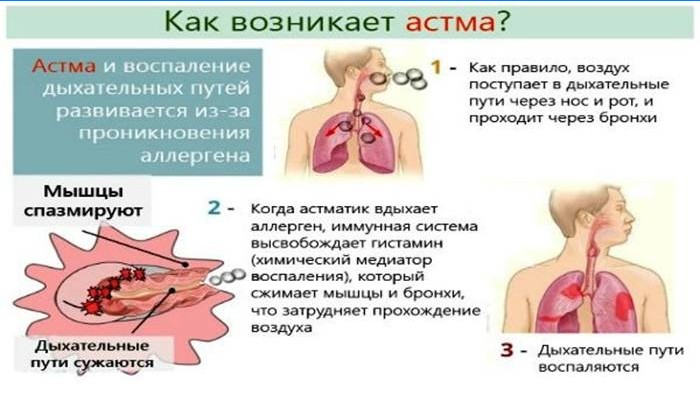Kuidas astma tekib?
